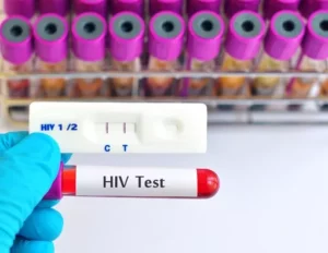 024156000 1641290286 waktu tepat tes hiv setelah berhubungan tanpa pelindung