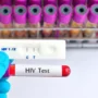 024156000 1641290286 waktu tepat tes hiv setelah berhubungan tanpa pelindung