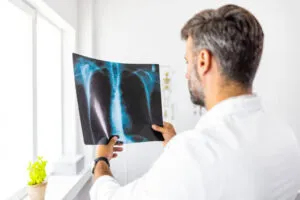 doctor checking the xray of pneumonia at hospital