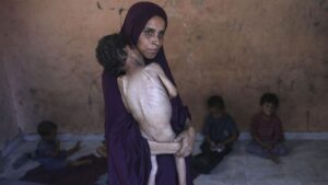 potret anak anak malnutrisi korban kelaparan di gaza 1753328471990 169