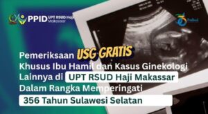 usg gratis