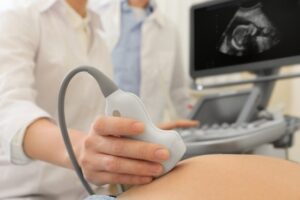 usg kehamilan pahami jenis dan kapan perlu dilakukannya 0 alodokter