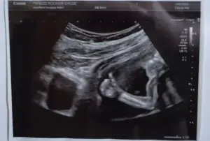 momen bayi angkat jempol