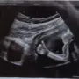momen bayi angkat jempol
