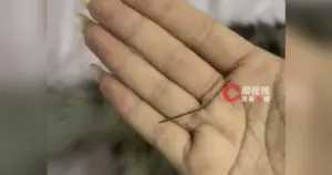 jarum nancap